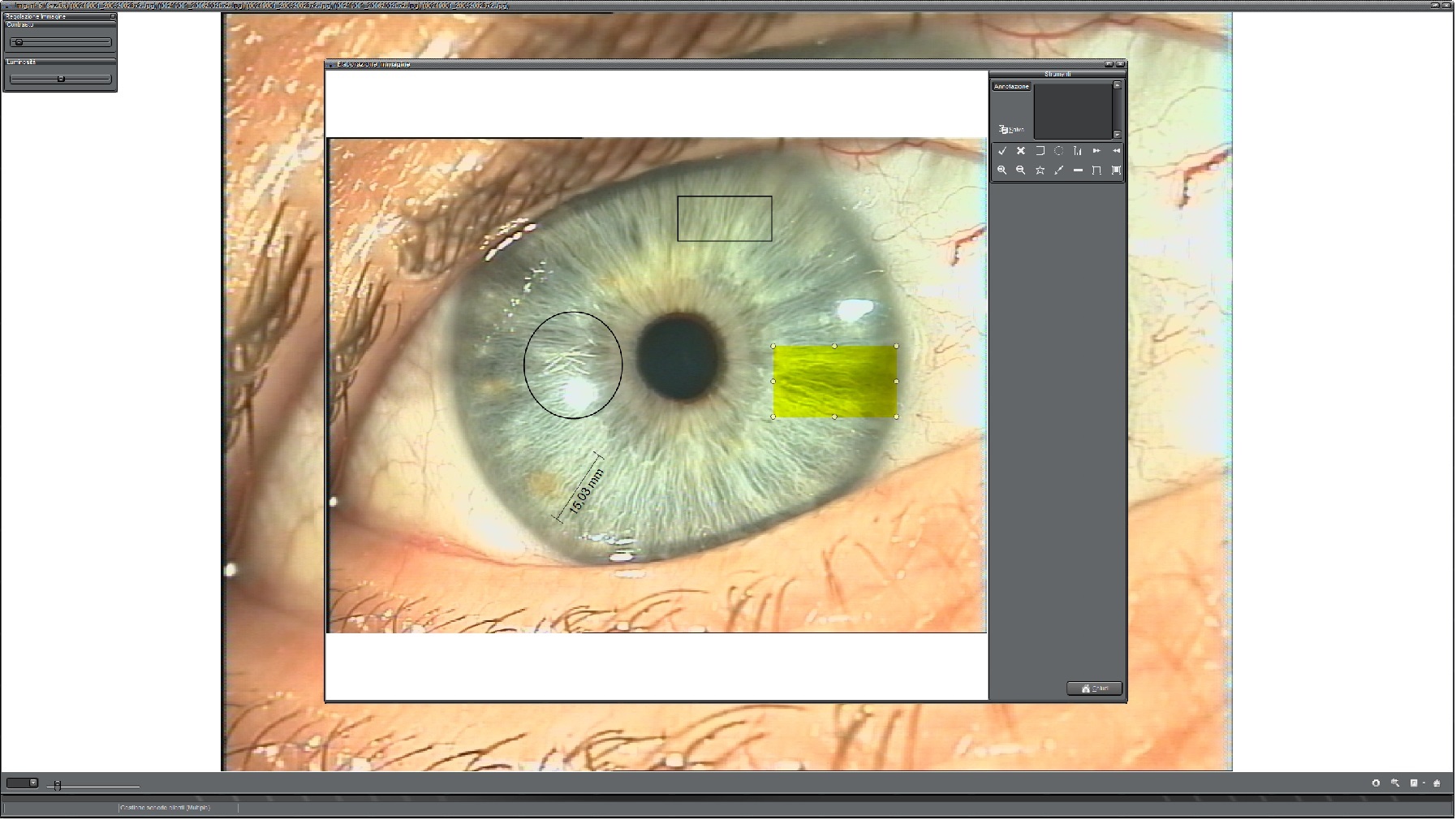 EyeTech Analisi Iride Singola