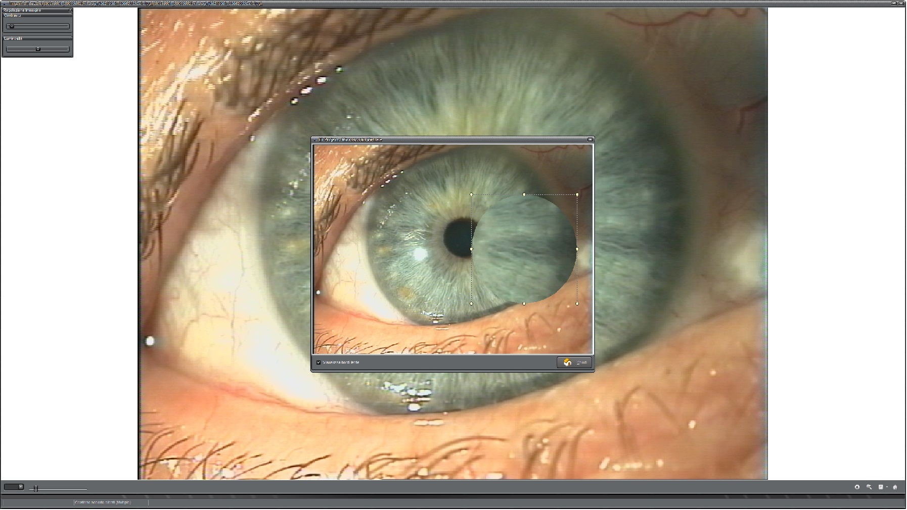 EyeTech Zoom Lente