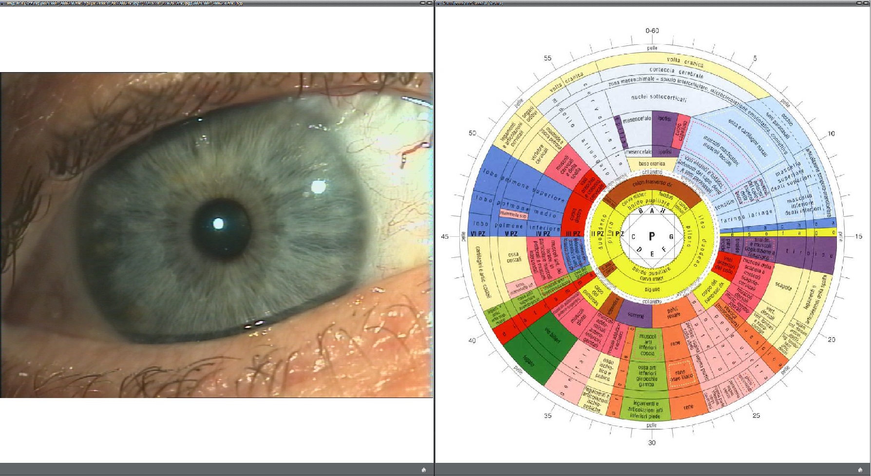 EyeTech Mappe Iridologiche